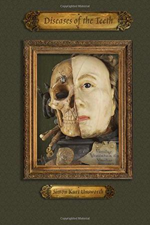 Diseases of the Teeth by Simon Kurt Unsworth